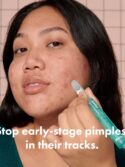 Hero Cosmetics Pimple Correct Acne Clearing Gel Pen