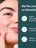 Mighty Patch Micropoint™ for Blemishes