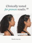 Nutrafol Women Hair Growth Supplements